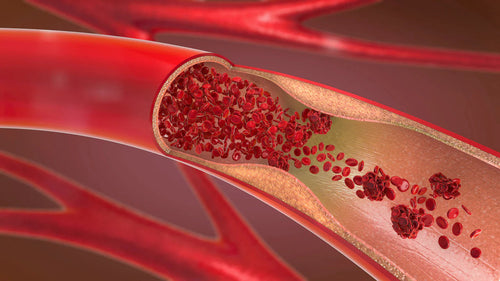 Nitric Oxide Support